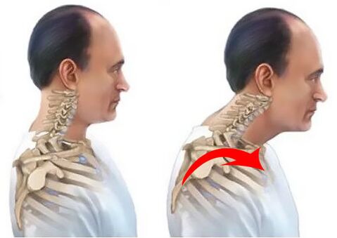 Cột sống khỏe mạnh và bệnh tật